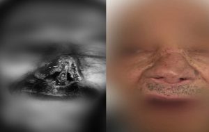 caso_cxplasticareconstructiva_centrooriente