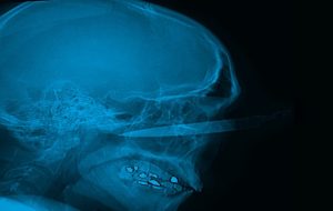 casosubredsur_armablanca11