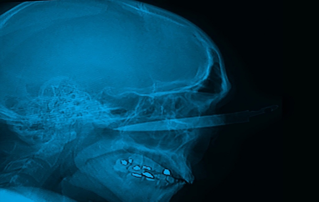 casosubredsur_armablanca11